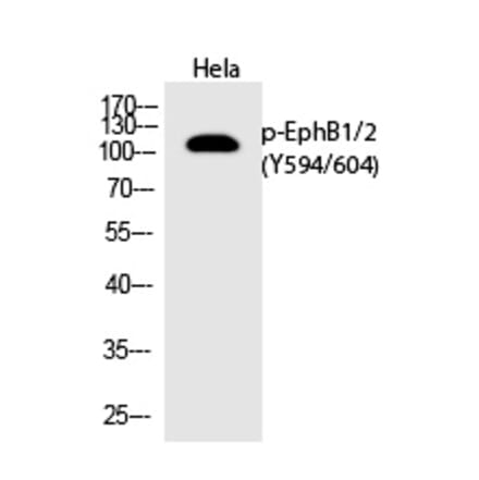 Western blot - EphB1/2 (Phospho-Tyr594/604) Polyclonal Antibody from Signalway Antibody (12273) - Antibodies.com