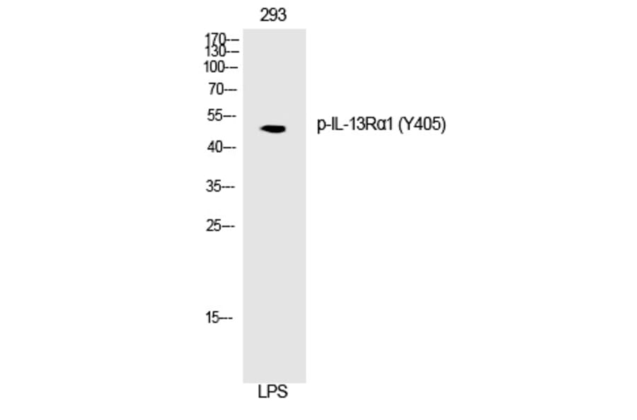 Western blot - IL-13Rα1 (Phospho-Tyr405) Polyclonal Antibody from Signalway Antibody (12276) - Antibodies.com