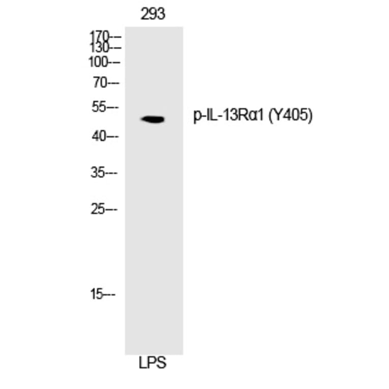 Western blot - IL-13Rα1 (Phospho-Tyr405) Polyclonal Antibody from Signalway Antibody (12276) - Antibodies.com