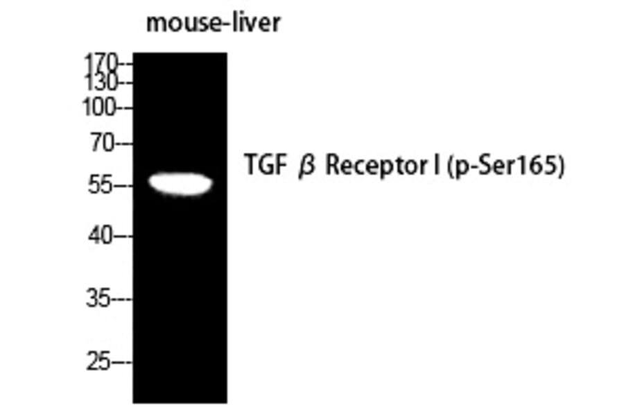 Western blot - TGFβ RI (Phospho-Ser165) Polyclonal Antibody from Signalway Antibody (12388) - Antibodies.com