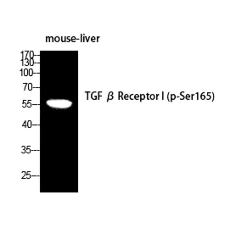 Western blot - TGFβ RI (Phospho-Ser165) Polyclonal Antibody from Signalway Antibody (12388) - Antibodies.com