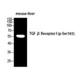 Western blot - TGFβ RI (Phospho-Ser165) Polyclonal Antibody from Signalway Antibody (12388) - Antibodies.com