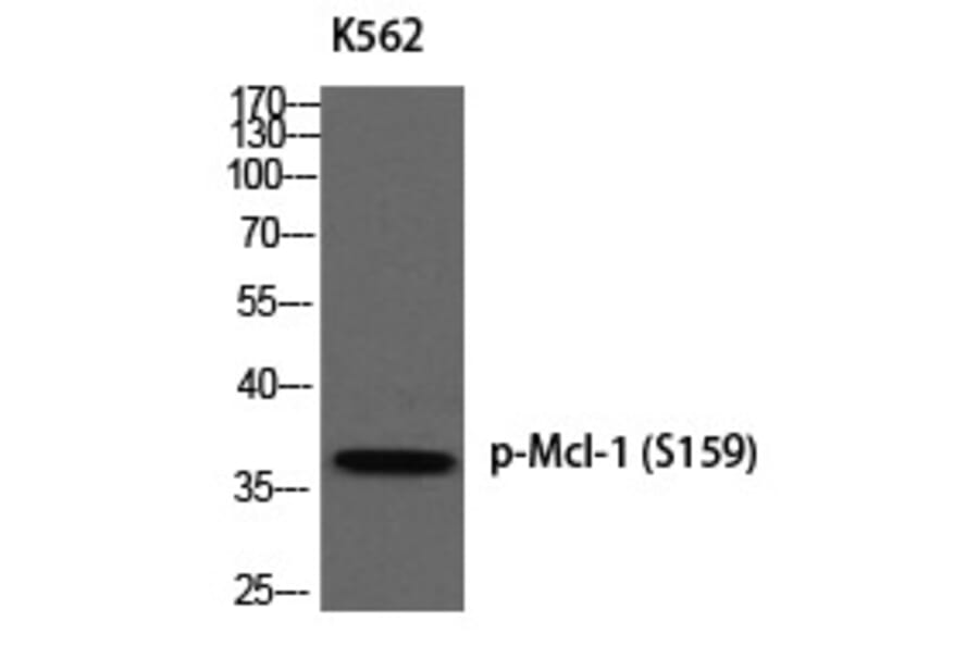 Western blot - Mcl-1 (Phospho-Ser159) Polyclonal Antibody from Signalway Antibody (12387) - Antibodies.com