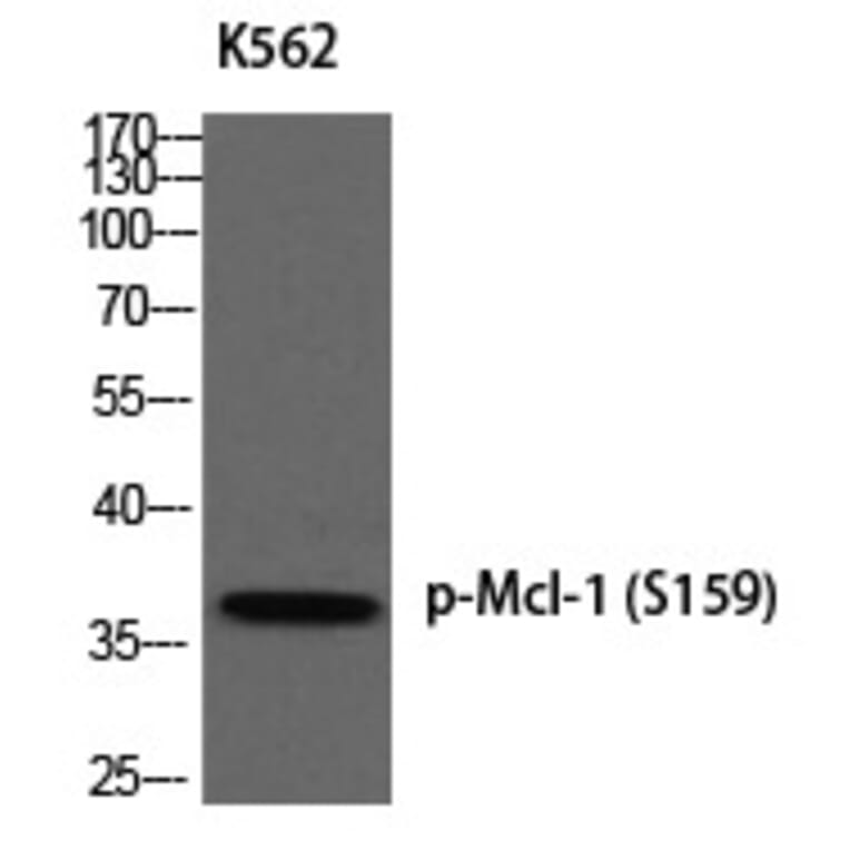 Western blot - Mcl-1 (Phospho-Ser159) Polyclonal Antibody from Signalway Antibody (12387) - Antibodies.com