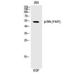 Western blot - Brk (Phospho-Tyr447) Polyclonal Antibody from Signalway Antibody (12268) - Antibodies.com