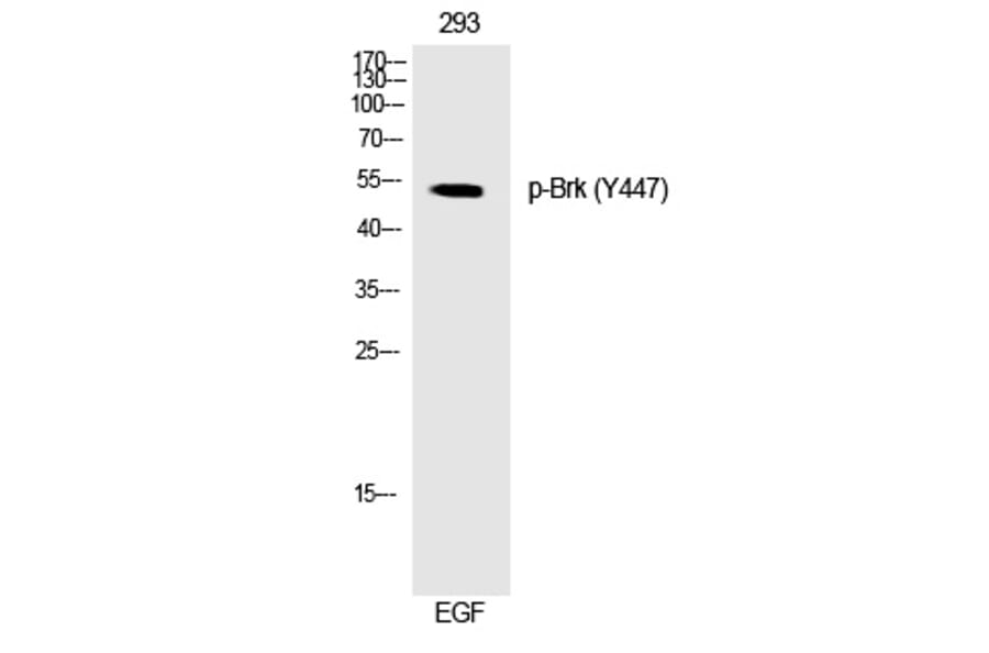 Western blot - Brk (Phospho-Tyr447) Polyclonal Antibody from Signalway Antibody (12268) - Antibodies.com