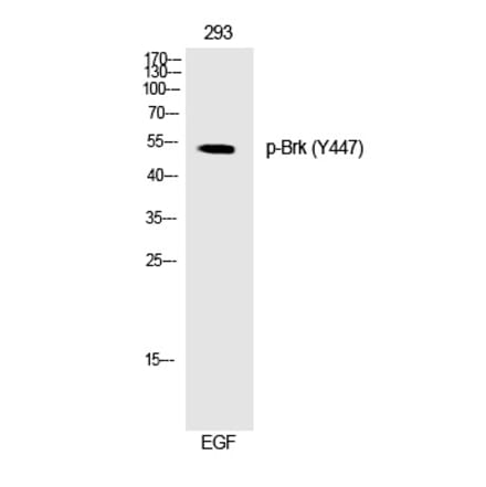 Western blot - Brk (Phospho-Tyr447) Polyclonal Antibody from Signalway Antibody (12268) - Antibodies.com