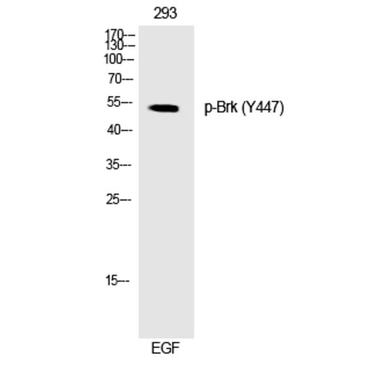 Western blot - Brk (Phospho-Tyr447) Polyclonal Antibody from Signalway Antibody (12268) - Antibodies.com