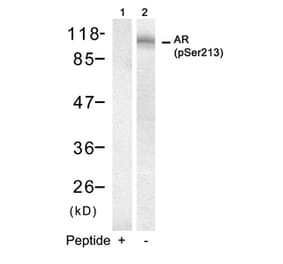 Western blot - Androgen Receptor (Phospho-Ser213) Antibody from Signalway Antibody (11119) - Antibodies.com