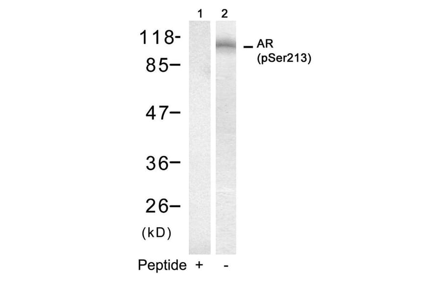 Western blot - Androgen Receptor (Phospho-Ser213) Antibody from Signalway Antibody (11119) - Antibodies.com