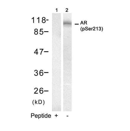 Western blot - Androgen Receptor (Phospho-Ser213) Antibody from Signalway Antibody (11119) - Antibodies.com