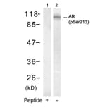 Western blot - Androgen Receptor (Phospho-Ser213) Antibody from Signalway Antibody (11119) - Antibodies.com