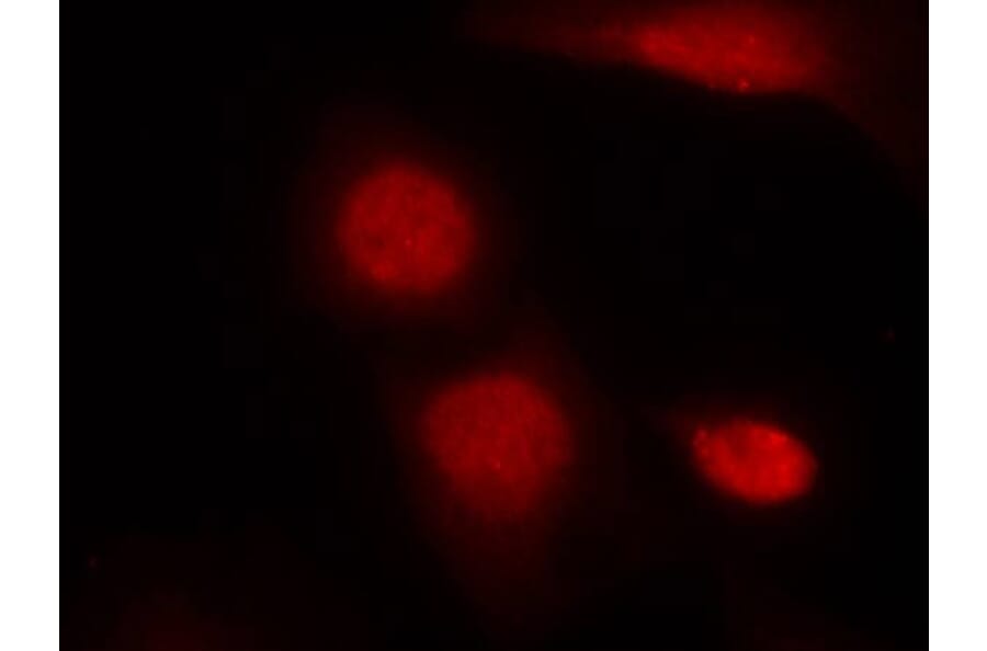 Immunofluorescence - Androgen Receptor (Phospho-Ser213) Antibody from Signalway Antibody (11119) - Antibodies.com