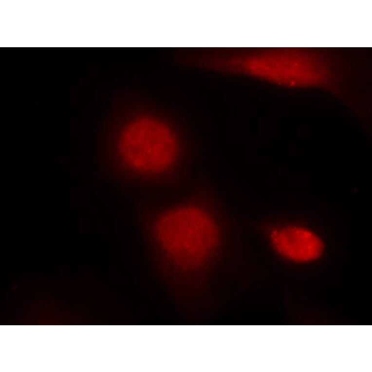 Immunofluorescence - Androgen Receptor (Phospho-Ser213) Antibody from Signalway Antibody (11119) - Antibodies.com