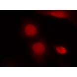 Immunofluorescence - Androgen Receptor (Phospho-Ser213) Antibody from Signalway Antibody (11119) - Antibodies.com
