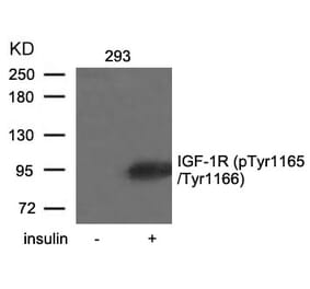 Western blot - IGF-1R (Phospho-Tyr1165/Tyr1166) Antibody from Signalway Antibody (11088) - Antibodies.com