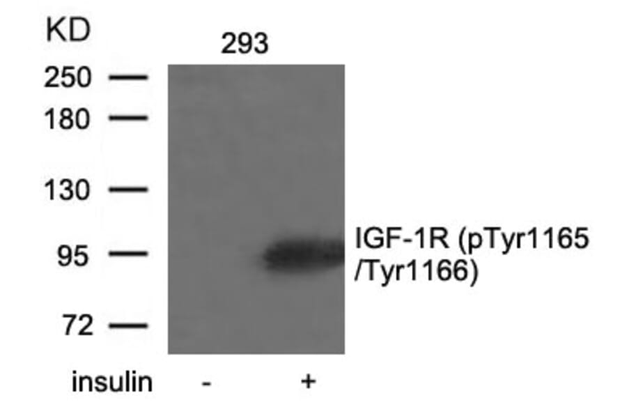 Western blot - IGF-1R (Phospho-Tyr1165/Tyr1166) Antibody from Signalway Antibody (11088) - Antibodies.com