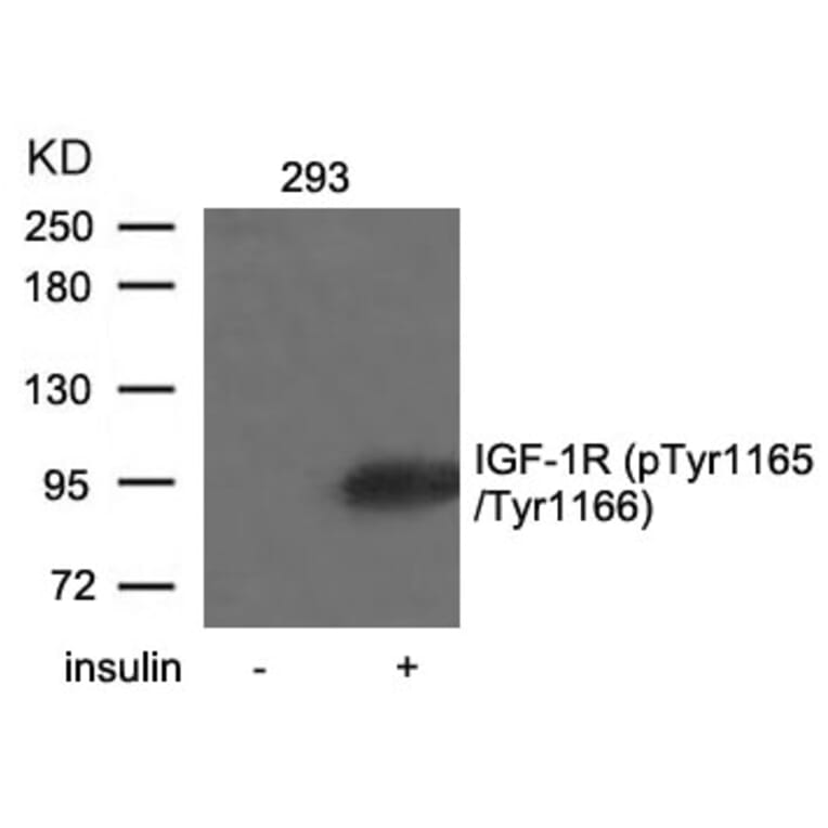 Western blot - IGF-1R (Phospho-Tyr1165/Tyr1166) Antibody from Signalway Antibody (11088) - Antibodies.com
