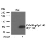 Western blot - IGF-1R (Phospho-Tyr1165/Tyr1166) Antibody from Signalway Antibody (11088) - Antibodies.com