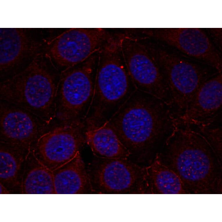Immunofluorescence - IGF-1R (Phospho-Tyr1165/Tyr1166) Antibody from Signalway Antibody (11088) - Antibodies.com