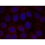 Immunofluorescence - IGF-1R (Phospho-Tyr1165/Tyr1166) Antibody from Signalway Antibody (11088) - Antibodies.com