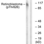 Western blot - Retinoblastoma (Phospho-Thr826) Antibody from Signalway Antibody (12106) - Antibodies.com