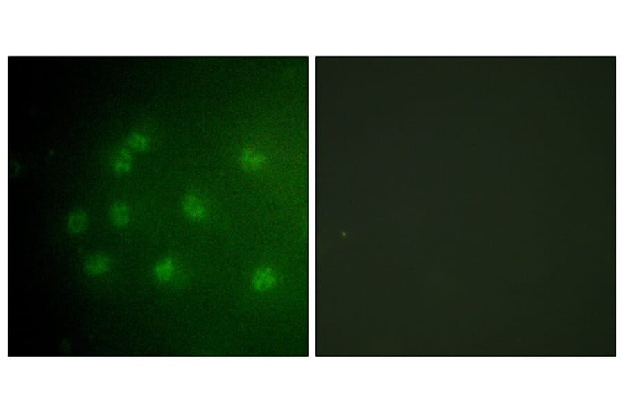 Immunofluorescence - Retinoblastoma (Phospho-Thr826) Antibody from Signalway Antibody (12106) - Antibodies.com