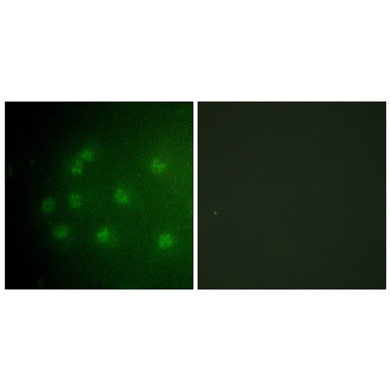 Immunofluorescence - Retinoblastoma (Phospho-Thr826) Antibody from Signalway Antibody (12106) - Antibodies.com