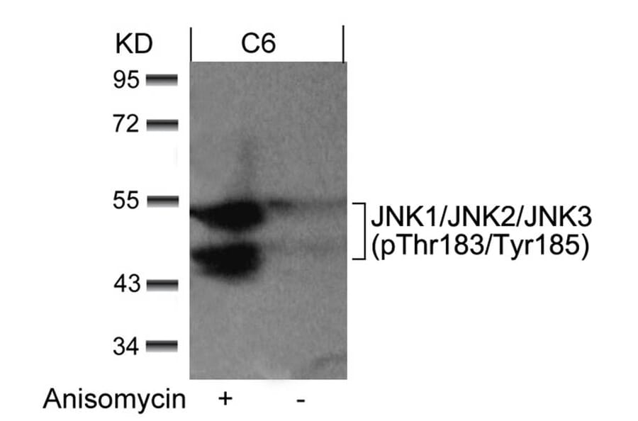 Western blot - JNK1/JNK2/JNK3 (phospho-Thr183/Tyr185) Antibody from Signalway Antibody (11504) - Antibodies.com