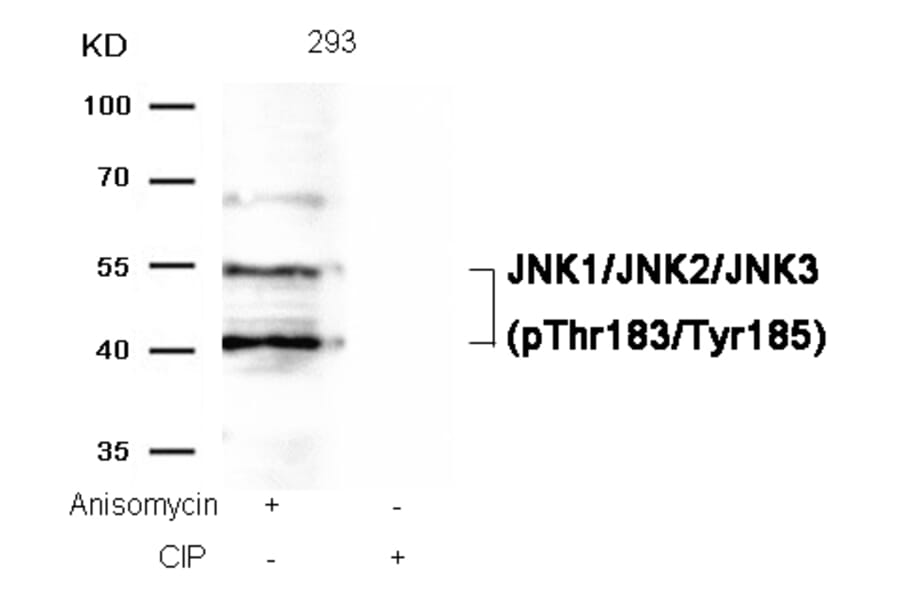 Western blot - JNK1/JNK2/JNK3 (phospho-Thr183/Tyr185) Antibody from Signalway Antibody (11504) - Antibodies.com