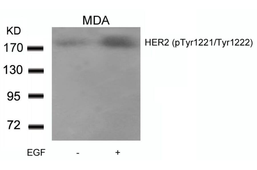 Western blot - HER2 (Phospho-Tyr1221/Tyr1222) Antibody from Signalway Antibody (11076) - Antibodies.com