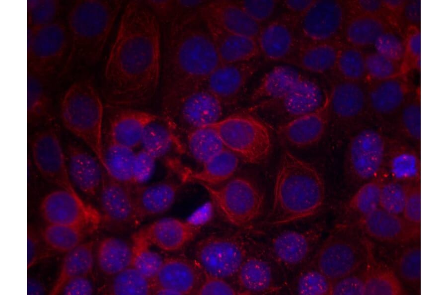 Immunofluorescence - HER2 (Phospho-Tyr1221/Tyr1222) Antibody from Signalway Antibody (11076) - Antibodies.com