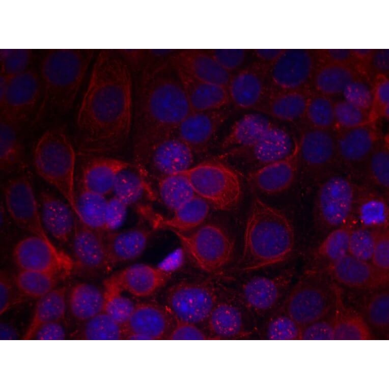 Immunofluorescence - HER2 (Phospho-Tyr1221/Tyr1222) Antibody from Signalway Antibody (11076) - Antibodies.com