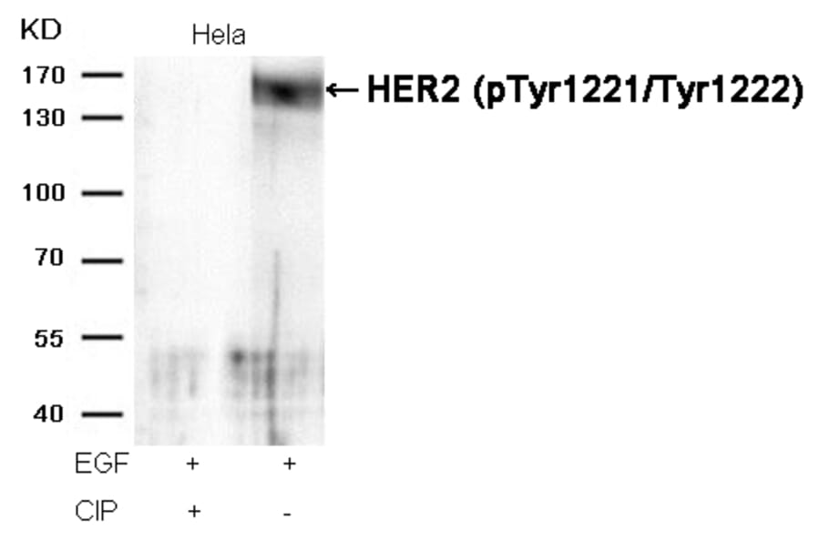 Western blot - HER2 (Phospho-Tyr1221/Tyr1222) Antibody from Signalway Antibody (11076) - Antibodies.com
