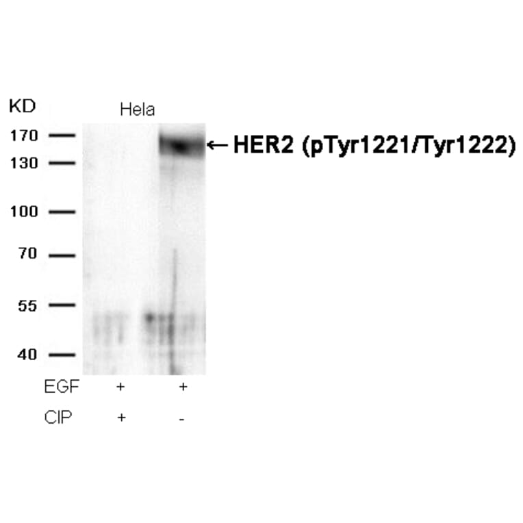Western blot - HER2 (Phospho-Tyr1221/Tyr1222) Antibody from Signalway Antibody (11076) - Antibodies.com