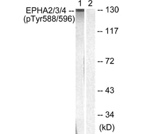 Western blot - EPHA2/3/4 (Phospho-Tyr588/596) Antibody from Signalway Antibody (11690) - Antibodies.com