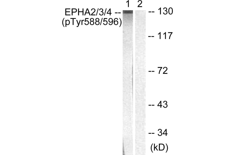 Western blot - EPHA2/3/4 (Phospho-Tyr588/596) Antibody from Signalway Antibody (11690) - Antibodies.com