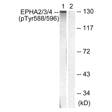Western blot - EPHA2/3/4 (Phospho-Tyr588/596) Antibody from Signalway Antibody (11690) - Antibodies.com