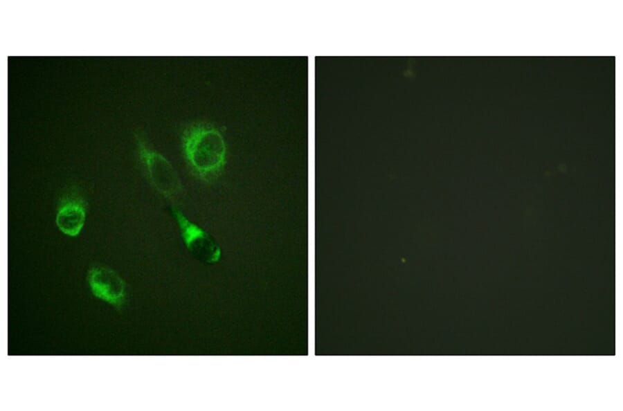 Immunofluorescence - EPHA2/3/4 (Phospho-Tyr588/596) Antibody from Signalway Antibody (11690) - Antibodies.com