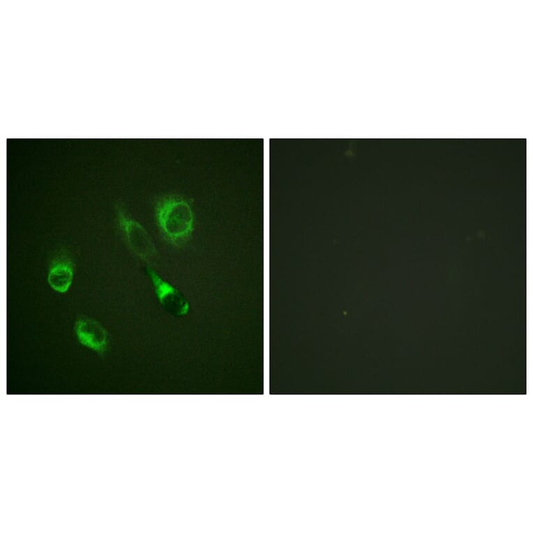 Immunofluorescence - EPHA2/3/4 (Phospho-Tyr588/596) Antibody from Signalway Antibody (11690) - Antibodies.com