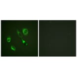 Immunofluorescence - EPHA2/3/4 (Phospho-Tyr588/596) Antibody from Signalway Antibody (11690) - Antibodies.com