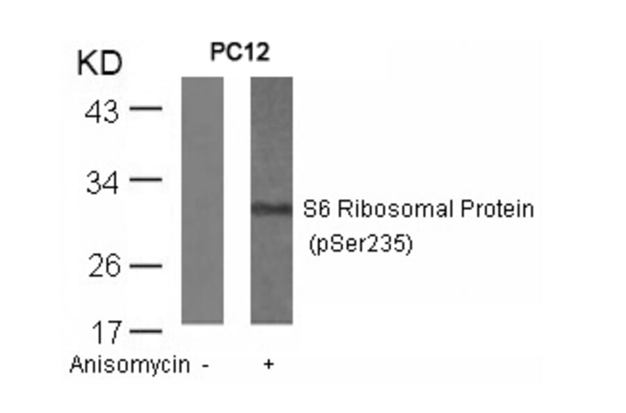 Western blot - S6 Ribosomal Protein (Phospho-Ser235) Antibody from Signalway Antibody (11232) - Antibodies.com