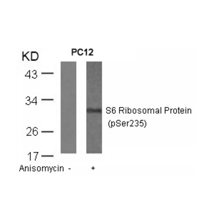 Western blot - S6 Ribosomal Protein (Phospho-Ser235) Antibody from Signalway Antibody (11232) - Antibodies.com