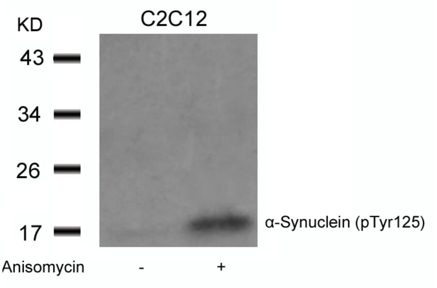 Western blot - a-Synuclein (Phospho-Tyr125) Antibody from Signalway Antibody (11256) - Antibodies.com
