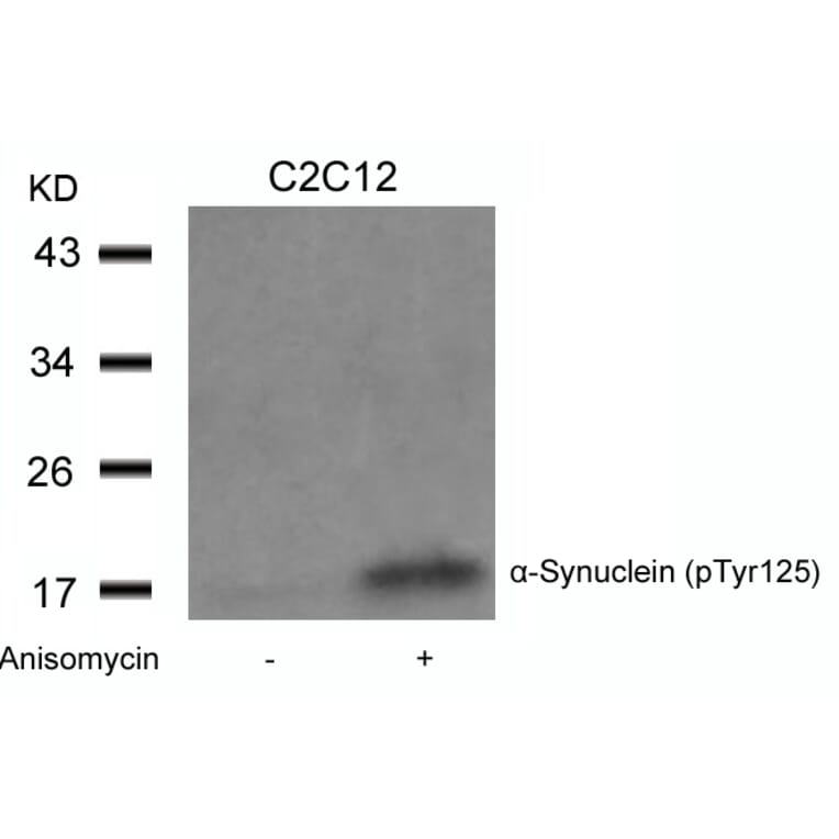 Western blot - a-Synuclein (Phospho-Tyr125) Antibody from Signalway Antibody (11256) - Antibodies.com
