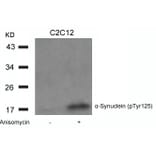 Western blot - a-Synuclein (Phospho-Tyr125) Antibody from Signalway Antibody (11256) - Antibodies.com