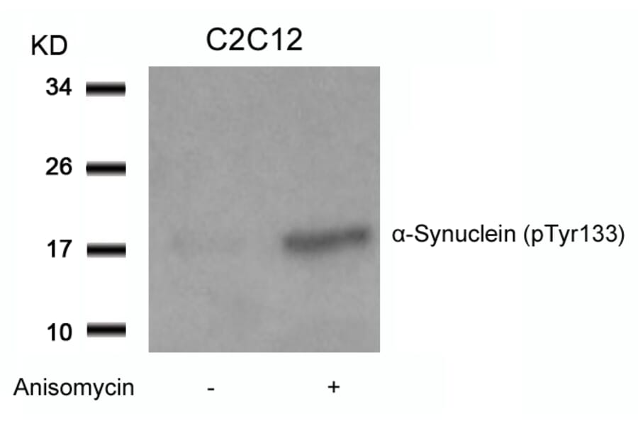 Western blot - a-Synuclein (Phospho-Tyr133) Antibody from Signalway Antibody (11285) - Antibodies.com