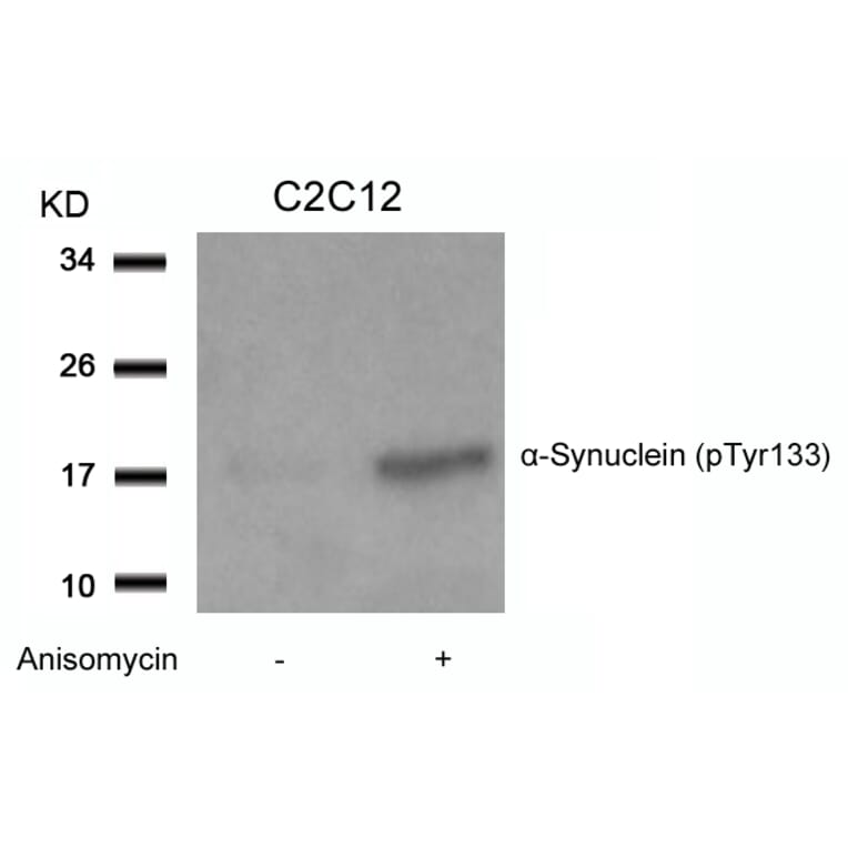 Western blot - a-Synuclein (Phospho-Tyr133) Antibody from Signalway Antibody (11285) - Antibodies.com
