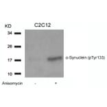 Western blot - a-Synuclein (Phospho-Tyr133) Antibody from Signalway Antibody (11285) - Antibodies.com