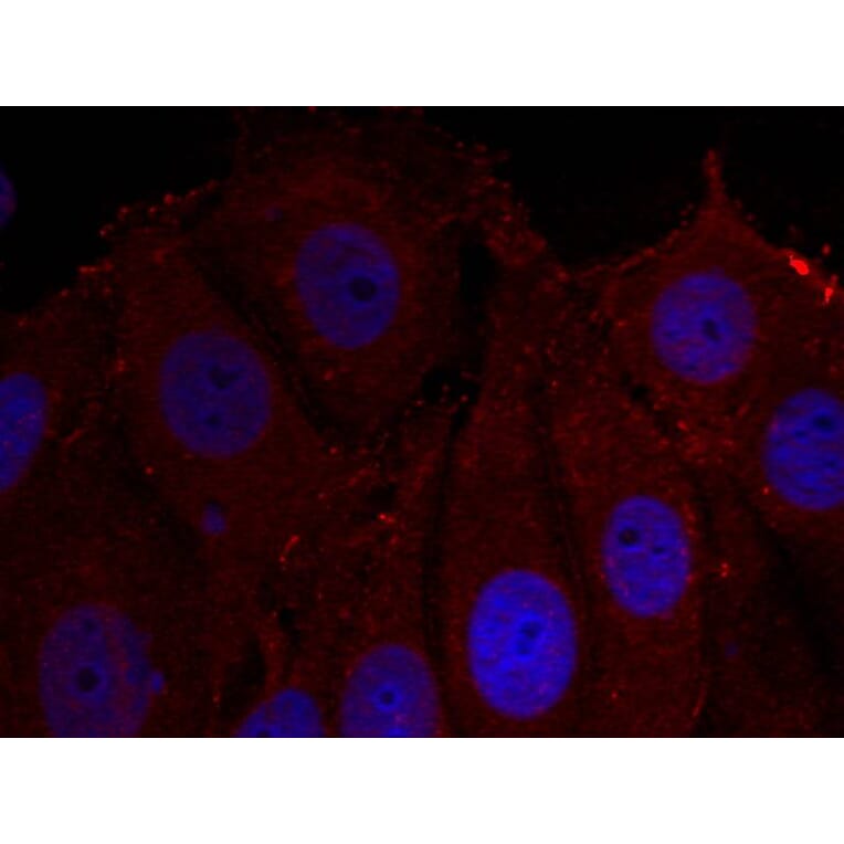 Immunofluorescence - a-Synuclein (Phospho-Tyr133) Antibody from Signalway Antibody (11285) - Antibodies.com
